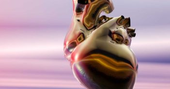 Heart Institute of East Texas Physicians Use World’s Smallest Heart Pump in Procedure at CHI St. Luke’s Health-Memorial